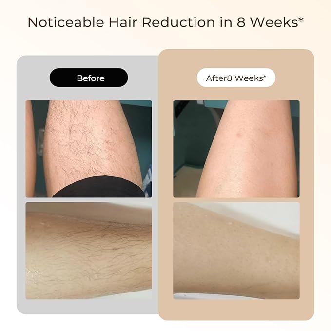 Laser Hair Removal, IPL Laser Hair Removal for Woman and Men Permanent, Hair Removal Device with 3.0 IPL Red Light Wave, Home Laser Hair Removal Device for Legs Armpits Back Bikini Body Use