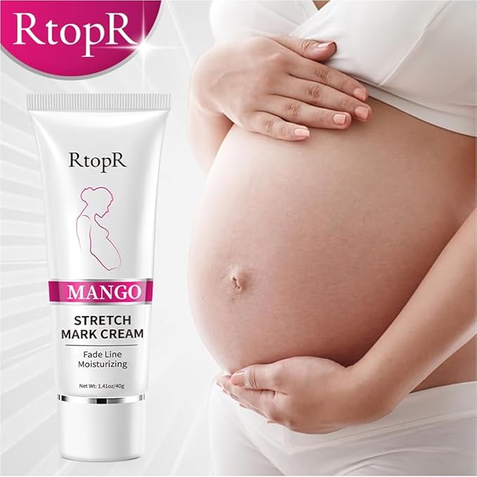 Stretch Mark Removal Cream, Obesity Stretch Mark Moisturizer, Postpartum Repair Stretch Mark Cream, Abdominal Stretch Mark Cream, Remove Marks (1 PCS)