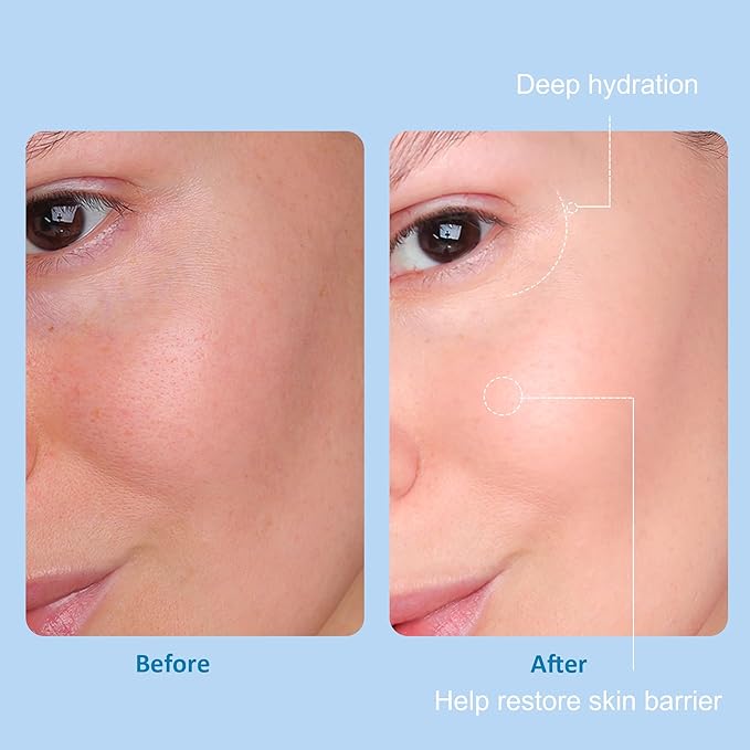 5 Step Skin Care Set, Large 17.6 Fl oz, All with Hyaluronic Acid Facial Skin Care Products, Makeup Remover, Cleanser, Toner, Serum, Lotion, Hydrating & Protect Skin, Sulfates & Paraben-Free