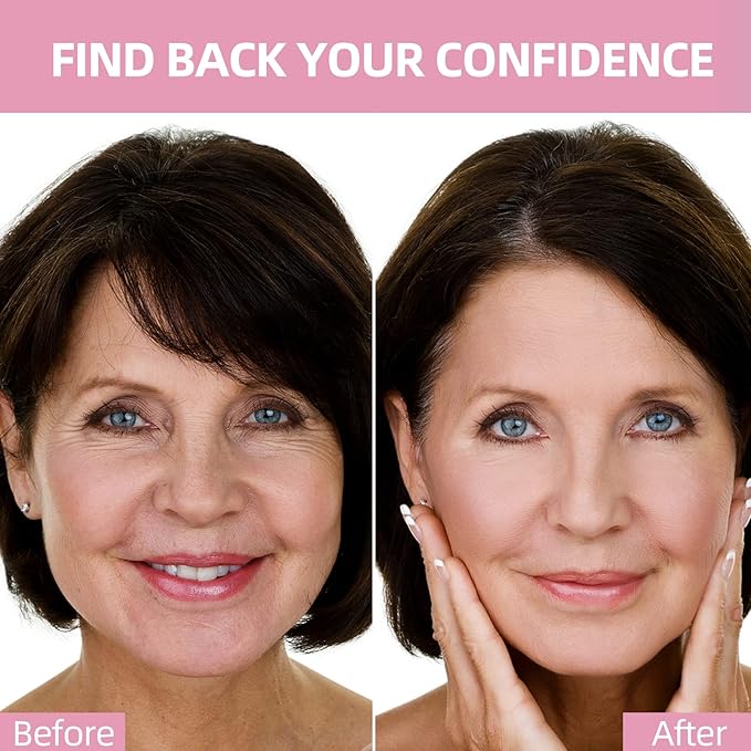 Face Wrinkle Patches – for Forehead Lines, Frown Areas, Smile Creases & Fine Signs – Overnight Anti-Aging Facial Stickers to Smooth Skin, Safe and Gentle for All Skin Types, 160 Pcs Included