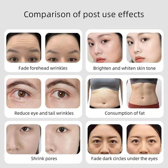 Comfortable Home Beauty Instrument, Deep Firming Technology, Strong Skin Firming, Remove Black Spots and Whiten Skin to Keep Young