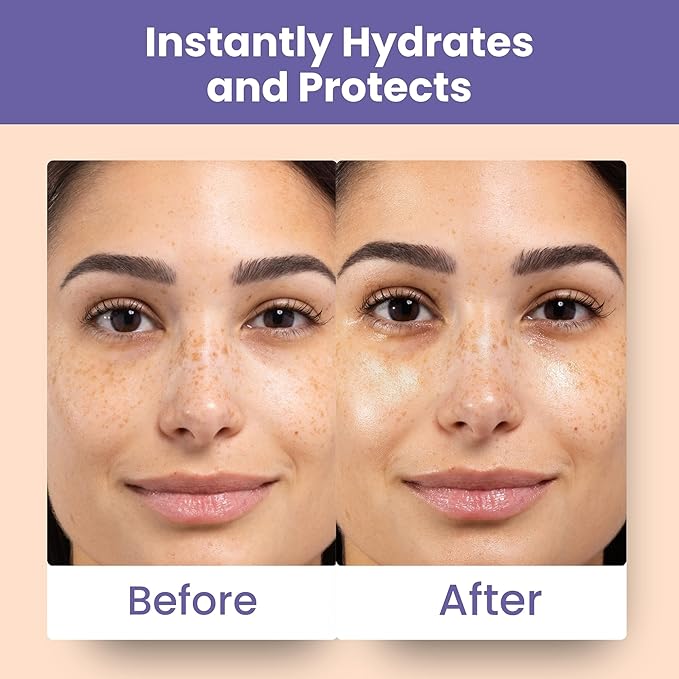 Patchology Skin Remedy Calm & Protect Micro Mist – Hydrating Facial Spray with Ectoin, Probiotics & Botanical Blend - Fragrance Free - Refines Pores & Leaves a Fresh Glow - 80 mL