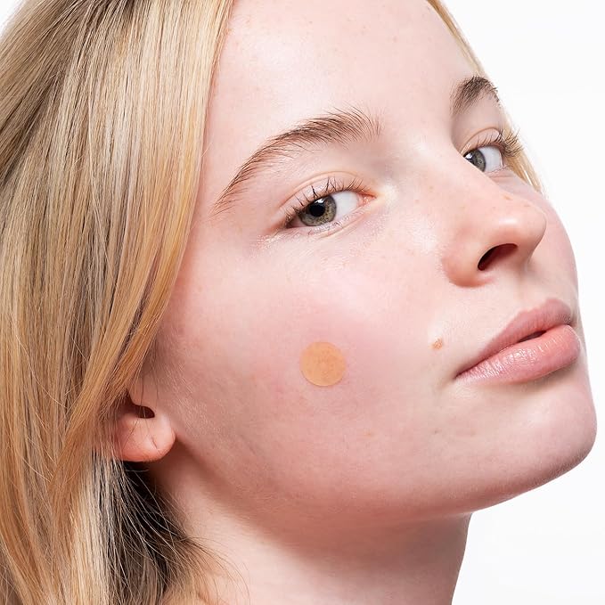 PEACE OUT Acne Healing Dots Helps Clear Blemishes Overnight, Fast Acting Hydrocolloid Pimple Patches for Breakouts with Salicylic Acid, Retinol and Aloe Vera, Award Winning Skincare Solution 10 Count