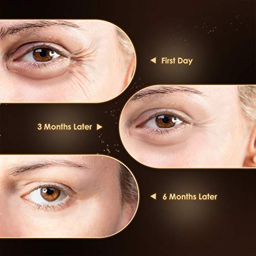 Anti Aging Eye Cream, Retinol Eye Cream Contains Niacinamide and Hyaluronic Acid, Reduces Wrinkles, Puffiness, Crows Feet and Dark Circles, 1 Oz