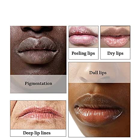 2pcs Lip Lightening for Dark Lips Lip Brightener for Smokers Dark Lip Treatment Lightening Cream for Pink Lips Lip Lightener for Smoker Lips Lip Lightening balm for Men and Women (Red)