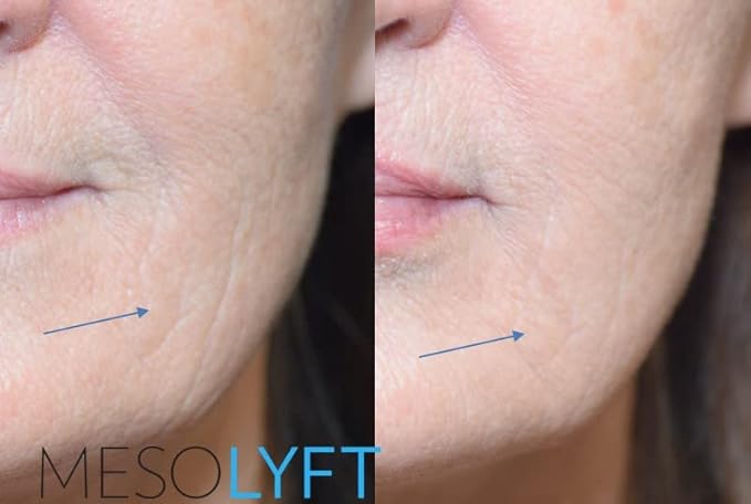 Power Combo Neck & eye Roller Brightening Face Serums for Anti-Aging Get Lip Pump's best Lip Plumper an Effectively Aging Skin Serum Multi-purpose, Eyes Neck & Décolleté Beauty Serum