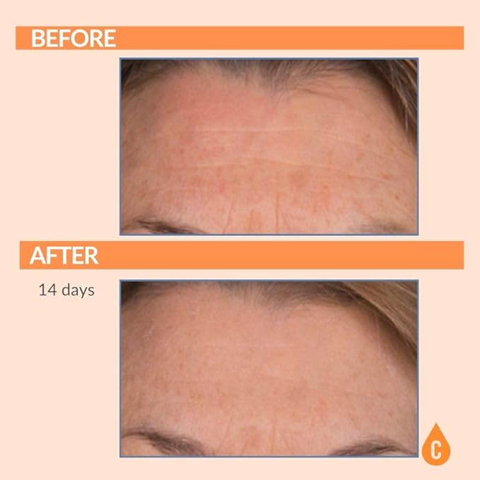 Serious Skincare Vitamin C Anti-Aging Facial Serum with Hydrolyzed Collagen - For Plump, Hydrated Skin - Brightening C3 Plasma Conditioner for Reducing Dark Spots, Fine Lines & Wrinkles 1 Fl Oz