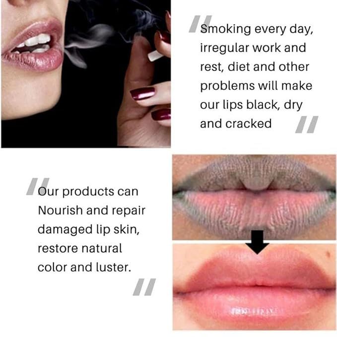 2PC Lip Balm Fade Dark Pigment Whitening Moisturizing Lip Hyaluronic Acid Exfoliating Dead Skin Lightening Lip Care (Yellow)