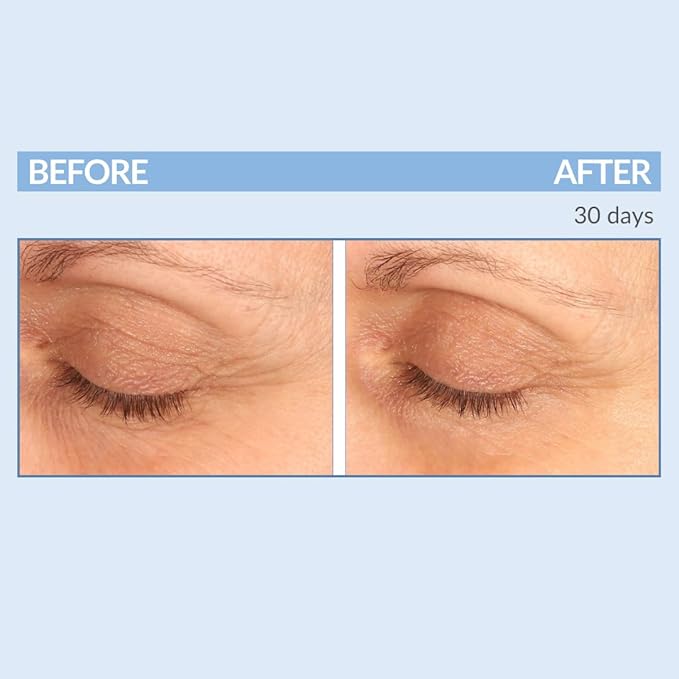 Serious Skincare - Eyetality Morning Total Eye Care Cream - For Lines, Wrinkles, Under Eye Puffiness and Dark Circles - Coffee Bean Extract - Vitamin C - Pomegranate - 0.5 oz