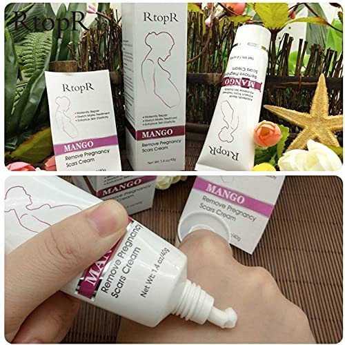 RtopR Mango Stretch Marks and Scar Cream -Stretch Marks and Scar Removal Cream for Pregnancy - Best Body Moisturizer-80g