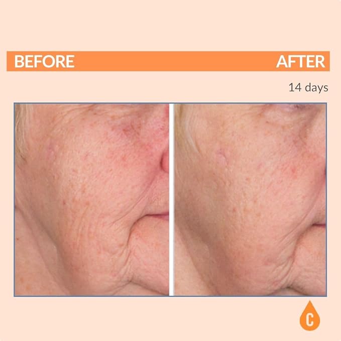 Serious Skincare Vitamin C Anti-Aging Facial Serum with Hydrolyzed Collagen - For Plump, Hydrated Skin - Brightening C3 Plasma Conditioner for Reducing Dark Spots, Fine Lines & Wrinkles 1 Fl Oz