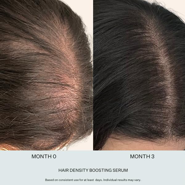 Stem Cell Serum for Men & Women - Helps Reduce Hair Loss - Strengthens & Thickens - Plant-Based - Combats Thinning Hair - Healthy Longer Hair - Root Nourishing Night (PM) - 28ml