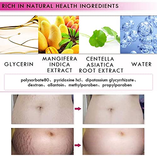 Mango Stretch Marks and Scar Cream, Stretch Marks and Scar Removal Cream for Pregnancy, Stretch Marks Scar Belly Creams for Wrinkles, Obesity Fat Stretch Mark Moisturizing, Remove Marks (40g)