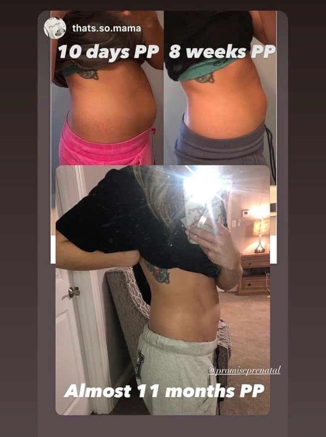 Promise Stretch Mark Prevention Bump Oil, Defense + Repair, Clean Pregnancy Skincare, Non-Toxic, Pregnancy Belly Oil, Vegan, Fast Drying