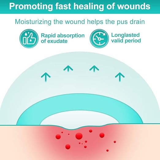 Dimora Hydrocolloid Dressing 4" x 4" for Wound Care, 10 Pack Large Patch Bandages with Self-Adhesive for Bedsore, Burn, Blister, Acne Care, Super Absorbent for Fast Healing