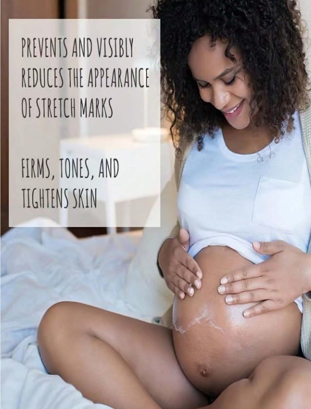 TRSTAY Stretch Mark Treatment Stretch Mark Cream (5, Grams)