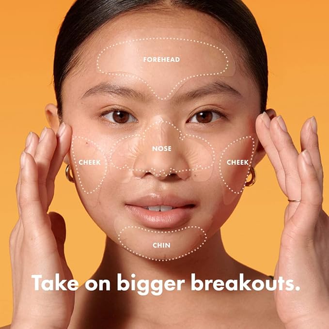 Hero Cosmetics Mighty Patch™ Face Patch - XL Hydrocolloid Face Mask for Acne, 5 Large Pimple Patches for Zit Breakouts on Nose, Chin, Forehead & Cheeks (1 Count)