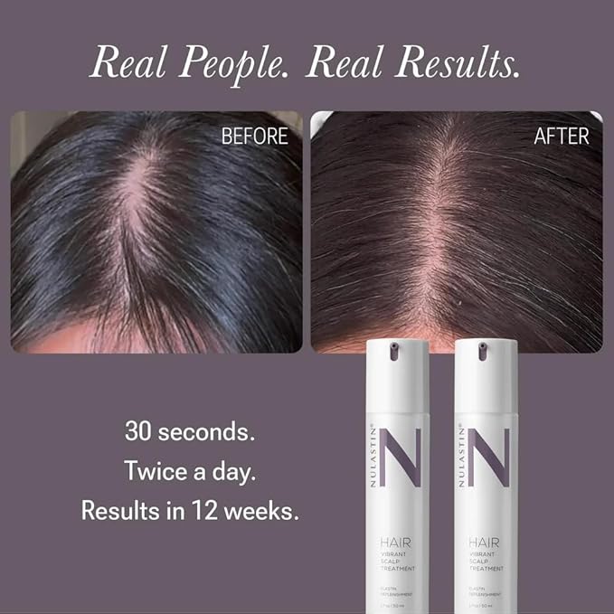 NULASTIN Hair Serum - HAIR Vibrant Scalp Treatment - Promote Scalp Care & Thicker Looking Volume in Thinning Hair - With Keratin & Peptides to Help Minimize Visible Shedding (1.7 Oz)
