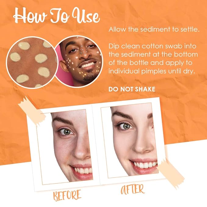 Bye Bye Blemish Dark Spot Lotion Vitamin C | Assists with Drying Blemishes And Brightening Skin | Fast Acting Solution | 1 Fl. Oz.