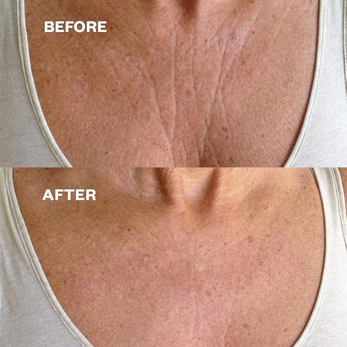 Wrinkles Schminkles Chest, Cleavage & Body Stretch Mark Wrinkle Patches | Reusable Hypoallergenic Pregnancy Safe Silicone Smoothing Pads to Prevent and Reduce Wrinkles & Stretch Marks | 2 Pack