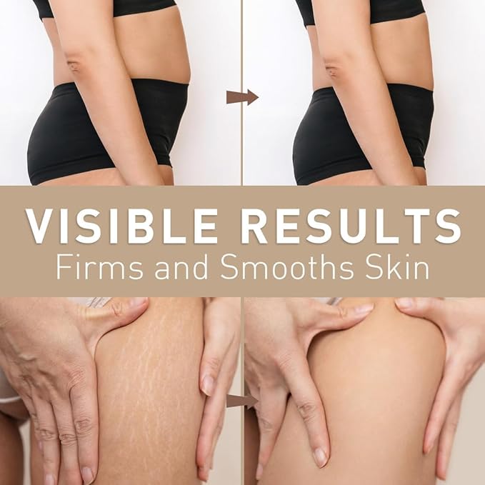 Belly Firming Cream: B Flat Skin Tightening Cream , Cellulite & Stretch Mark Reduction & Tummy Hips Cream & Body Firming for Stomach & Thighs & Arms – 3.38 Fl Oz