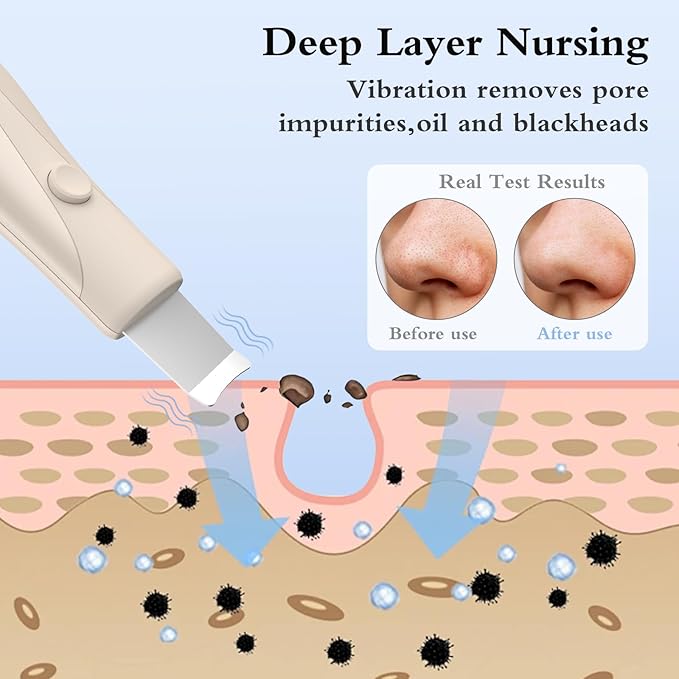 Skin Scrubber Face Spatula Skin Spatula Pore Cleaner Blackhead Remover Tools for Facial Deep Cleansing Skin Care Tool for Men and Women (Beige)