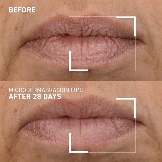 Dr. Brandt Microdermabrasion Smoothing Lip Scrub Gommage Lissant Levres 10 g / 0.35 oz