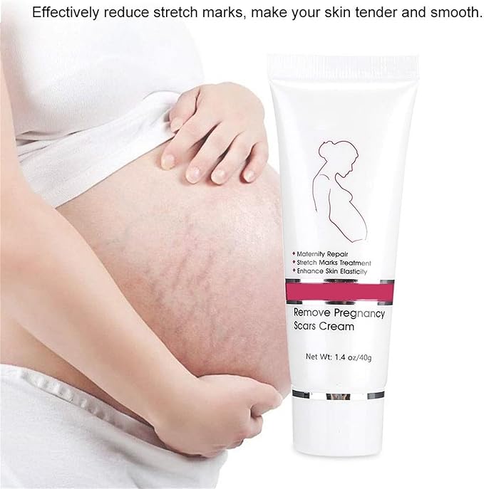 RtopR Stretch Marks and Scar Cream,Crema para Estrias De Embarazo,Stretch Marks Postpartum Repairing Cream Wrinkles Diluting Removal Cream Crema De Cacao para Cicatrices