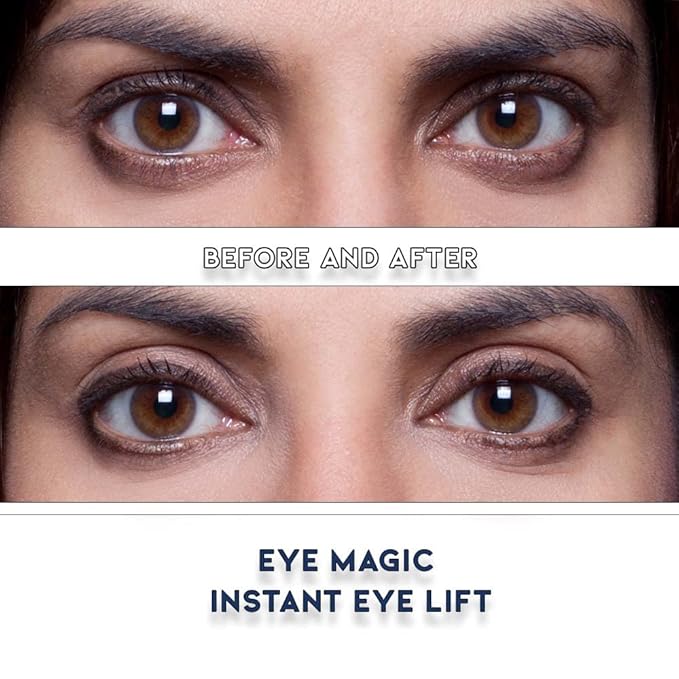 Eye Magic Premium Eye Lift (S/M Refill) Made in America. Instantly Lifts and Defines Droopy, Sagging or Hooded Eyes Safe for Daily Use