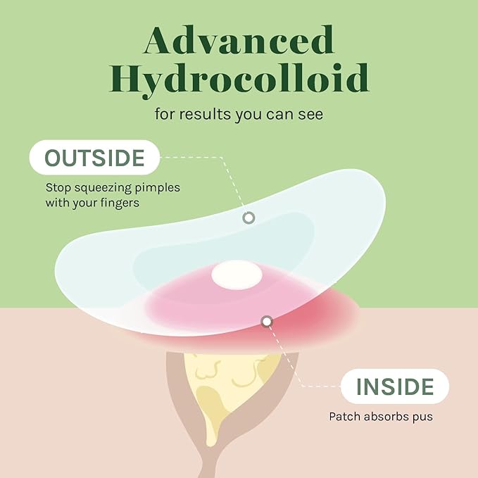 AOA Studio Absorbing Cover Healing Invisible Acne Patch Blemish Spot, Treatment, Facial Acne Patch Vegan, Cruelty Free, Hydrocolloid, Two Sizes 10mm 12mm (Total 84 Counts)