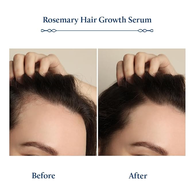 Blue Nectar Hair Growth Serum with Rosemary Oil for Hair Growth | Ayurvedic Hair Tonic Spray (8 Herbs, 3.38 Fl Oz)