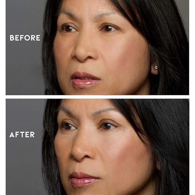 Eye Magic Premium Eye Lift (S/M Kit + Gel) Made in America Instantly Lifts and Defines Droopy, Sagging or Hooded Eyes Safe For Daily Use