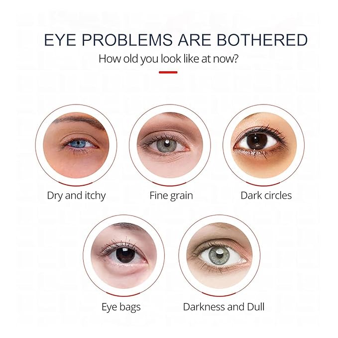 Open eyes awaken peptide lifting eye gel,peptide eye lifting gel,Reduces Dark Circles, Dark circles Hydrating firming Eye cream (1PCS)