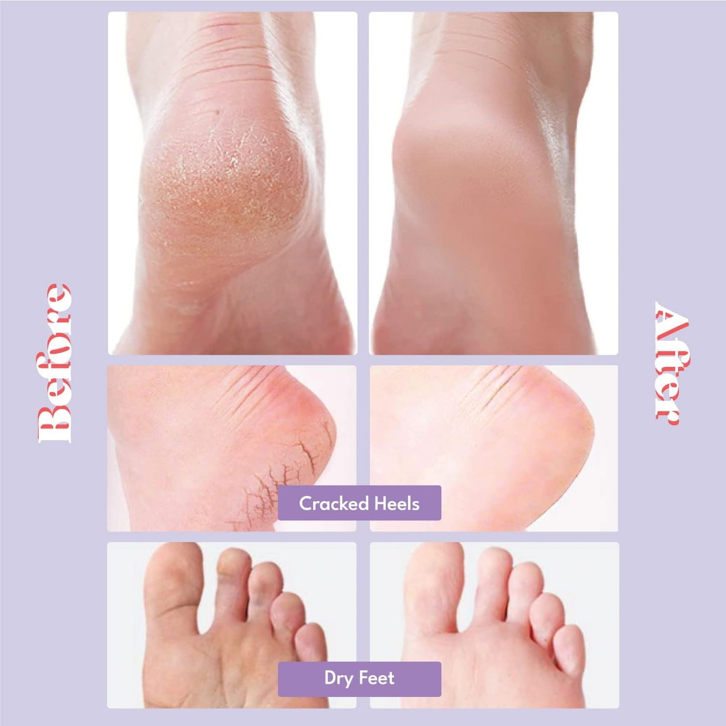 Toi:L Extra Silky Foot Mask 5 Pairs, Post-Peeling Foot Care Treatment, Moisturizing Socks with Guerande Salt & Sweet Almond Oil for Dry Feet, Cracked Heels, and Callus