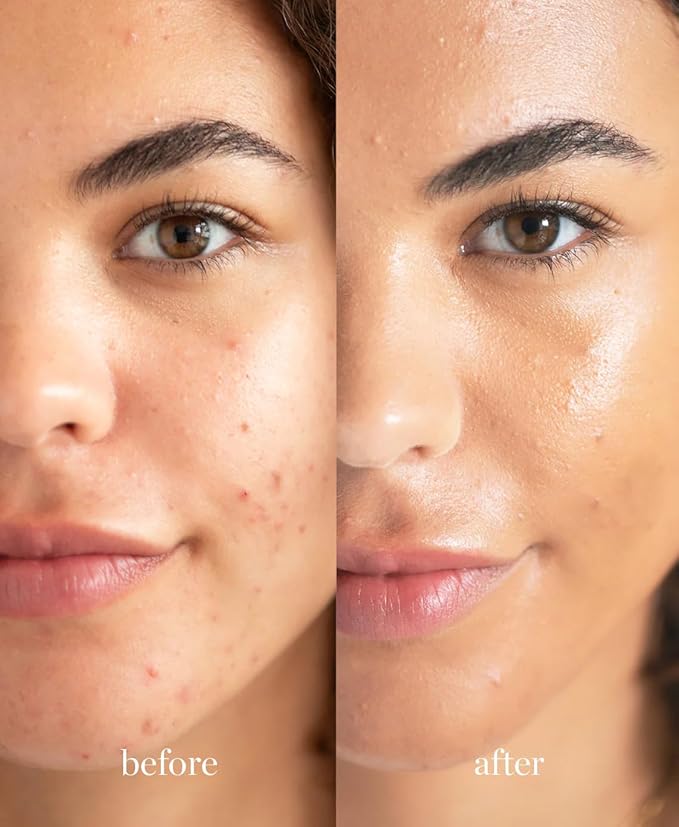 Ere Perez - Natural Lychee Crème Corrector | Vegan, Cruelty-Free, Clean Beauty (Cinco – Golden Pecan, 0.33 oz | 10 ml)