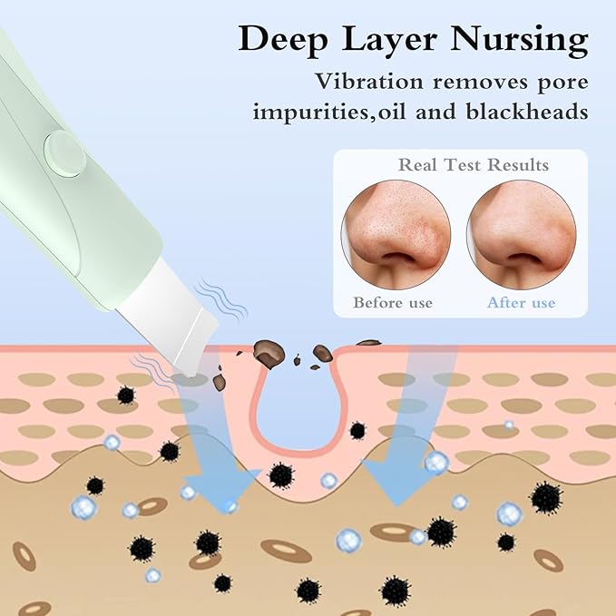 Skin Scrubber Face Spatula Skin Spatula Pore Cleaner Blackhead Remover Tools for Facial Deep Cleansing Skin Care Tool for Men and Women (Green)