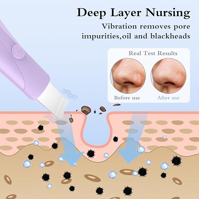 Skin Scrubber Face Spatula Skin Spatula Pore Cleaner Blackhead Remover Tools for Facial Deep Cleansing Skin Care Tool for Men and Women (Purple)