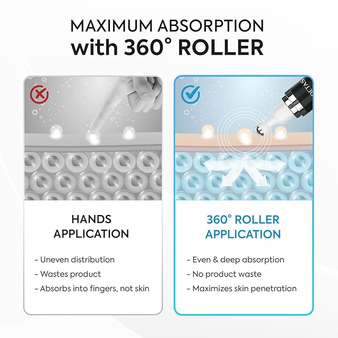 Dark Spot Remover for Face: Remove Sun & Age Spot Corrector – Melasma & Hyperpigmentation Brightening Serum for Body(Hand Leg Arm) – Brown Skin and Freckles Removal Treatment with Roller 15ml