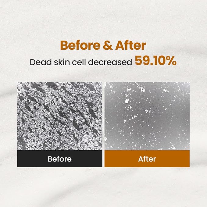 Enzyme Cleansing Powder – 40g (1.41 oz) – Purifies Pores, Removes Blackheads & Whiteheads, With Papain Enzyme for Smooth & Clear Skin | Low pH, Non-Irritating, For Sensitive Skin