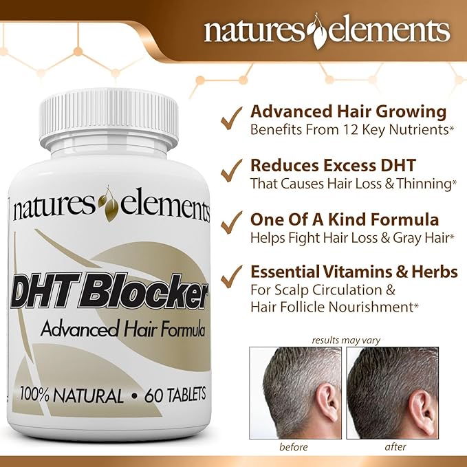 Natures Elements DHT Blocker – Herbal Formula with Saw Palmetto, Fo-Ti & Beta-Sitosterol – Supports Hair Regrowth & Gray Hair Reversal – 60 Tablets – Non-GMO, Vegetarian