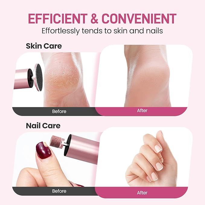 Electric Foot Callus Remover, 2 in 1 | 6 Speed Adjustable Foot File Nail Grinder with Sandpaper Disks, Professional Sander Pedicure Tool for Feet Dead Skin, Self Care Gifts for Women Mom Lover Friends