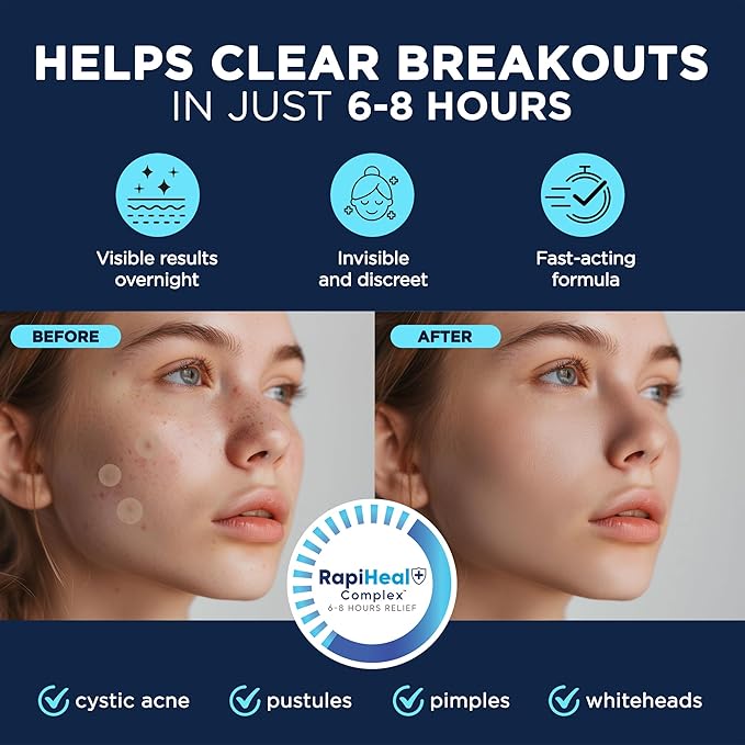 Pimple Patches for Face - 134 Count Hydrocolloid Acne Patches - Zit, Blemish, Cystic Acne Dots & Dark Spot Treatment - Invisible Clear Pimple Patch Stickers for Forehead, Chin, Nose, 3 Sizes (S, M, L)