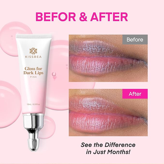 Lip Lightening for Dark Lips: for Smokers, Dry or Uneven-Toned Lips – Restores Natural Look & Moisture with VC, Lemon Peel & Licorice – Refreshing Mint Scent – 15 mL
