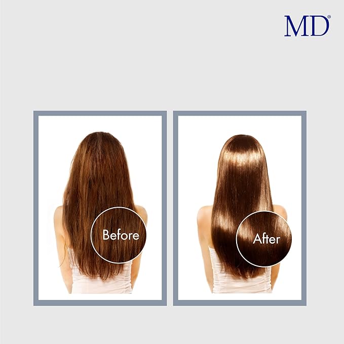 MD Revitalizing Shampoo for Men & Women – Sulphate-Free Hair Thinning Shampoo with Aloe Vera, Chamomile – Hair Loss, Regrowth Anti Thinning Shampoo for All Hair Types