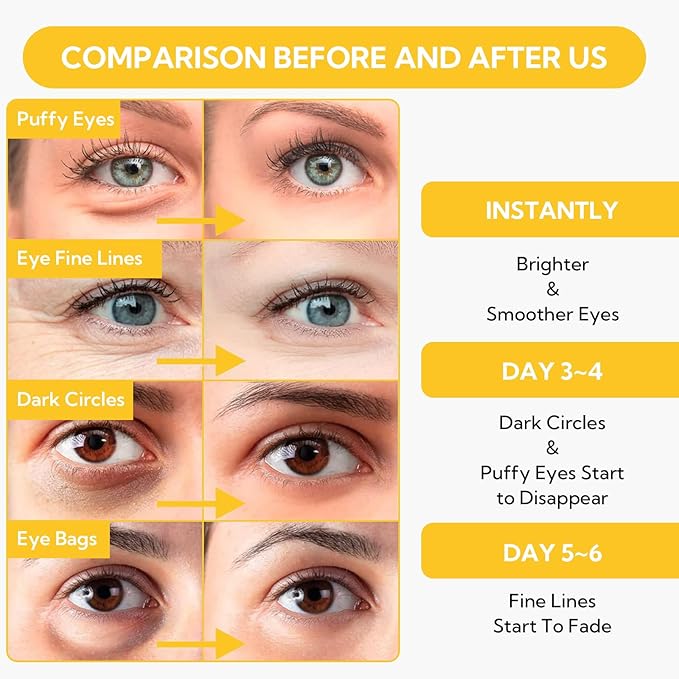 LANBENA 24K Gold Under Eye Patches(30 Pairs) -Cooling Eye Masks for Fine Lines Reduce, with Caffeine Niacinamide Tetrapeptide Hydra-Gel Collagen, Puffy Eyes & Dark Circles & Eye Bags Treatment
