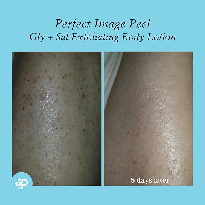 Perfect Image Gly + Sal Exfoliating Body Lotion, 8% Glycolic Acid and 2% Salicylic Acid Lotion Enhanced with Green Tea, Papaya, Bearberry, Licorice and Amino Complex