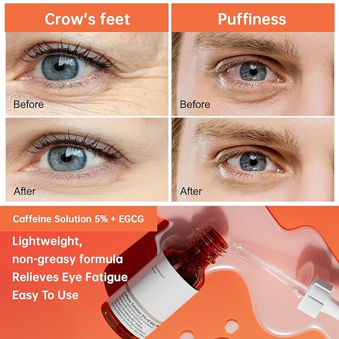 The Caffeine Solution 5% + EGCG，Reduces Appearance of Eye Contour Pigmentation and Puffiness，Under Eye Serum (30ml) Caffeine For Face Moisturizing Serum (1)