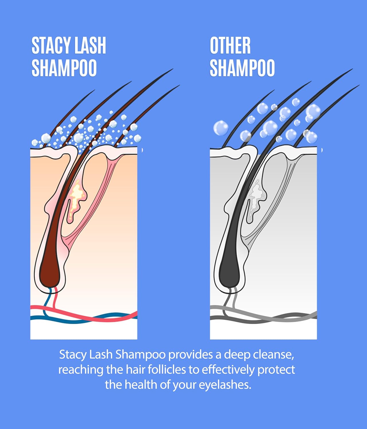 STACY LASH Eyelash Extension Shampoo + Brush / 3.38 fl.oz / 100ml / Eyelid Foaming Cleanser/Wash for Extensions & Natural Lashes/Safe Makeup Remover/Supplies for Professional & Home Use