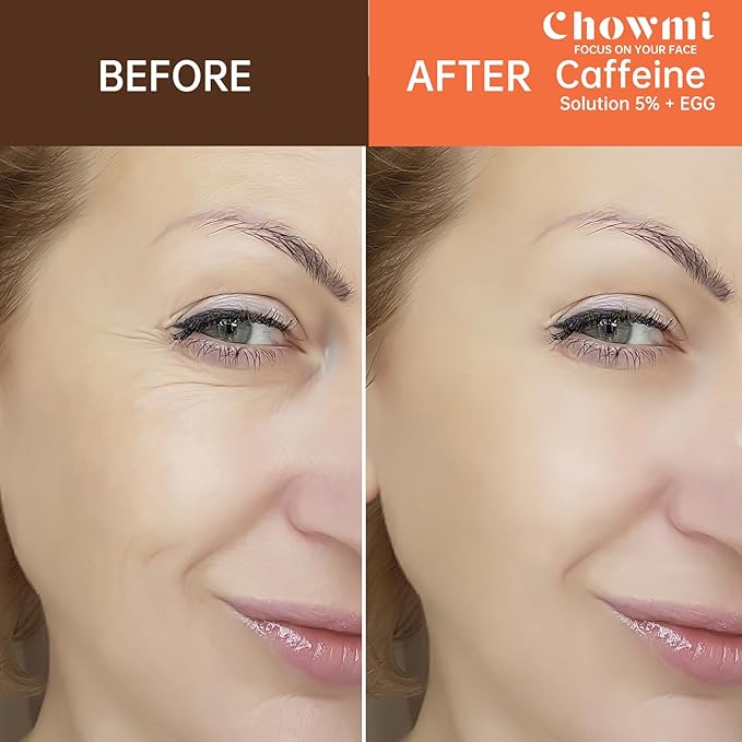 The Caffeine Solution 5% + EGCG，Reduces Appearance of Eye Contour Pigmentation and Puffiness，Under Eye Serum (30ml) Caffeine For Face Moisturizing Serum (1)