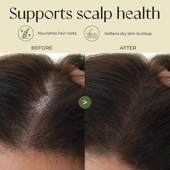 Gya Labs Rosemary & Castor Hair Growth & Styling Oil - 4 Fl Oz - Rosemary to Strengthen Hair - Protect & Tame Frizz, Dry Scalp - Hair & Scalp Hydration with 0.17 Fl Oz Deep Revival Argan Oil